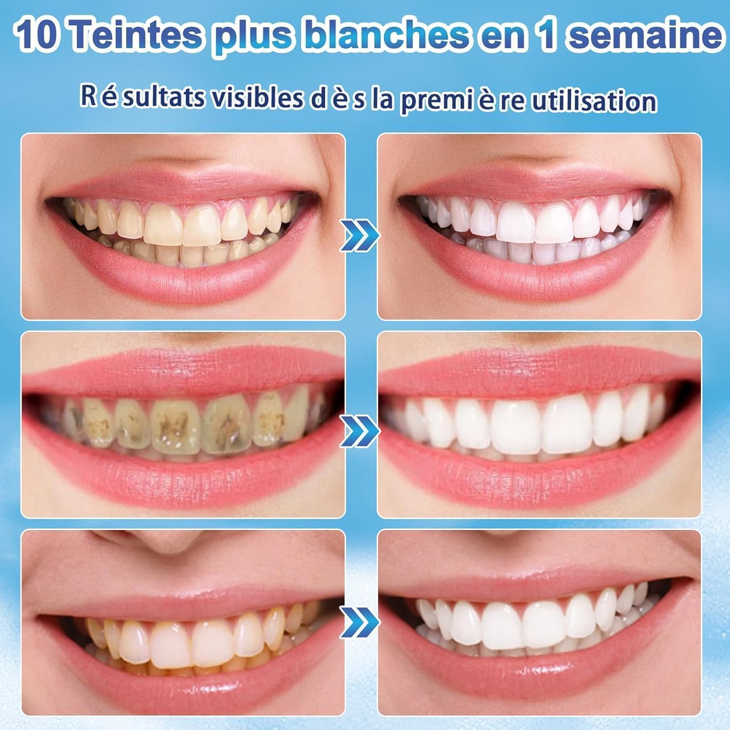 1767587619 kit stylo blanchiment dentaire 4 pieces